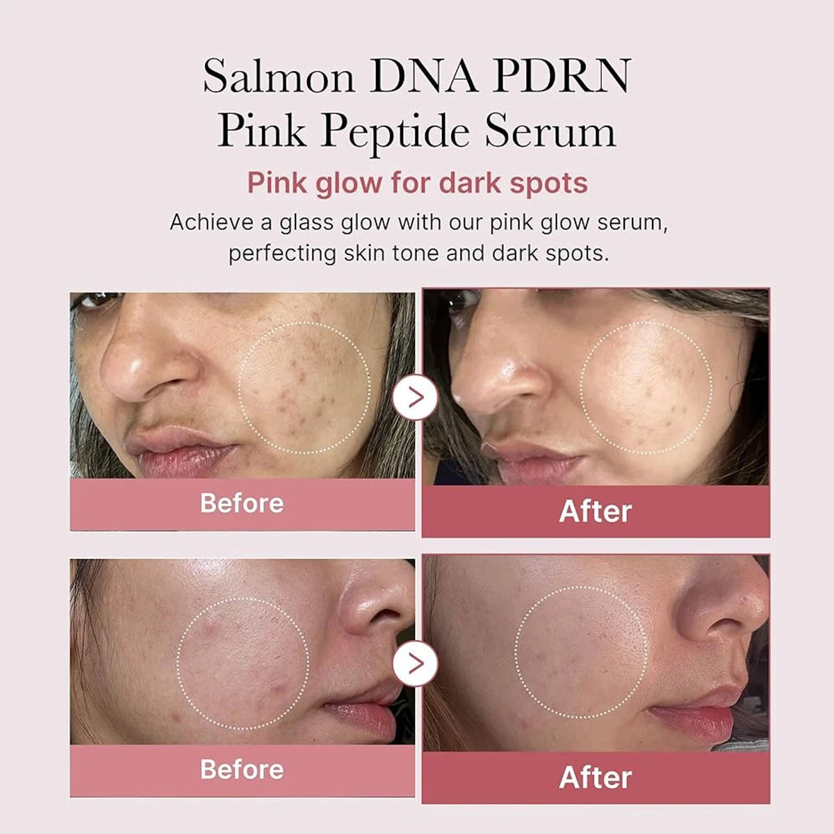 Medicube Salmon DNA PDRN Pink Peptide Serum,Serum Texture,Complex Repair Ingredients,Lifting & Firming,K-Beauty,Korean Makeup FRESKA