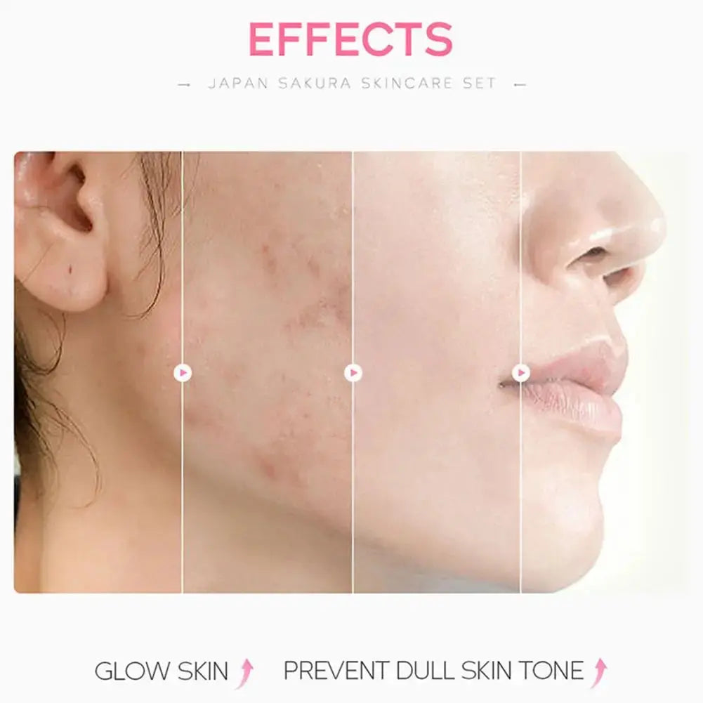 Effets du soin visage Sakura avant/après